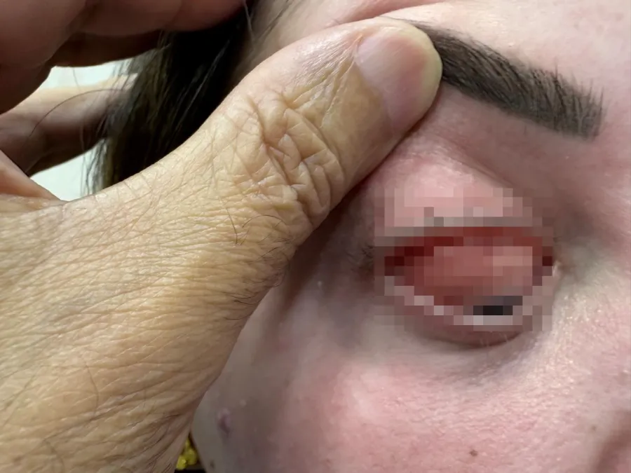 تشخيص دقيق ينقذ أردنية من مرض نادر (صور)